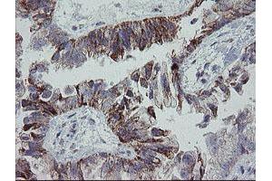 Image no. 1 for anti-Mitochondrial Ribosomal Protein S27 (MRPS27) (AA 151-414) antibody (ABIN1490963) (MRPS27 antibody  (AA 151-414))