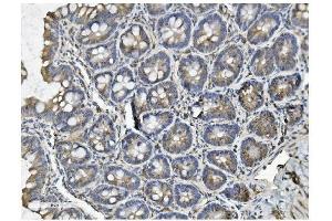 IHC analysis of Clathrin heavy chain/CLTC using anti-Clathrin heavy chain/CLTC antibody (ABIN7602704). (Clathrin Heavy Chain (CLTC) (AA 967-1668) antibody)