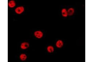 ABIN6277201 staining HepG2 by IF/ICC.