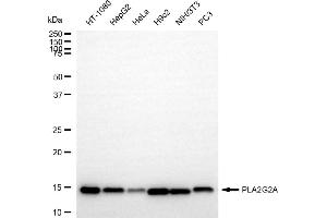 anti-Phospholipase A2, Group IIA (Platelets, Synovial Fluid) (PLA2G2A) antibody