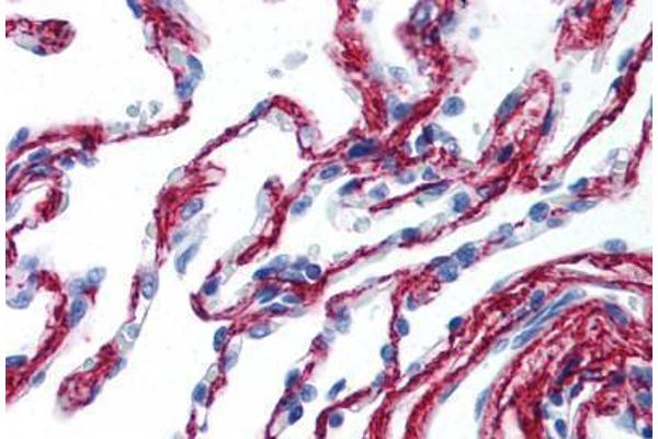 COL6 antibody