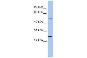 WB Suggested Anti-CTRB1 Antibody Titration:  0. (CTRB1 antibody  (N-Term))