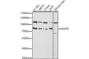 Western blot analysis of extracts of various cell lines, using Rad18 antibody (ABIN6128609, ABIN6146628, ABIN6146630 and ABIN6217430) at 1:1000 dilution. (RAD18 antibody  (AA 216-495))