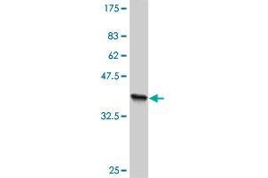 Western Blot detection against Immunogen (36. (TLN1 antibody  (AA 1052-1149))
