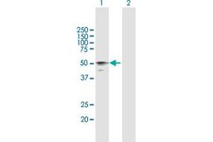Western Blot analysis of HYAL3 expression in transfected 293T cell line by HYAL3 MaxPab polyclonal antibody. (HYAL3 antibody  (AA 1-417))