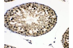 Immunohistochemistry (IHC) image for anti-Eukaryotic Translation Initiation Factor 6 (EIF6) (AA 66-210) antibody (ABIN4950900)