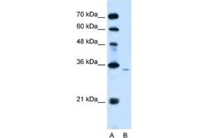 Western Blotting (WB) image for anti-Phosphatidic Acid Phosphatase Type 2A (PPAP2A) antibody (ABIN2462534) (PPAP2A antibody)