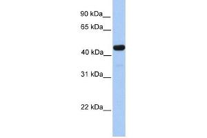 GAL3ST3 antibody used at 1 ug/ml to detect target protein. (GAL3ST3 antibody  (C-Term))