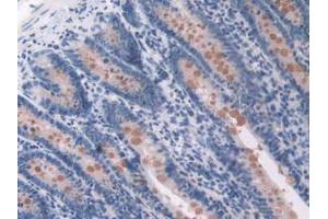 Figure. (OAS1 antibody  (AA 139-358))