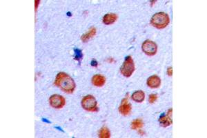 Immunohistochemical analysis of NMDAR1 staining in human brain formalin fixed paraffin embedded tissue section. (GRIN1/NMDAR1 antibody  (C-Term))
