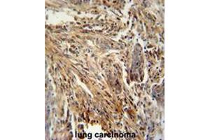Immunohistochemistry (Paraffin-embedded Sections) (IHC (p)) image for anti-Colony Stimulating Factor 2 (Granulocyte-Macrophage) (CSF2) (AA 62-89), (Middle Region) antibody (ABIN952558)