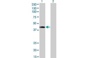 Western Blotting (WB) image for anti-AF4/FMR2 Family, Member 4 (AFF4) (AA 1-109) antibody (ABIN466197) (AFF4 antibody  (AA 1-109))
