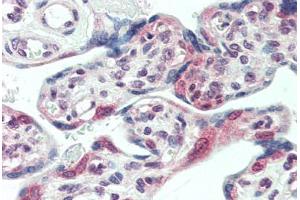 Human Placenta (formalin-fixed, paraffin-embedded) stained with CENPF antibody ABIN396951 at 10 ug/ml followed by biotinylated anti-mouse IgG secondary antibody ABIN481714, alkaline phosphatase-streptavidin and chromogen. (CENPF antibody  (AA 1759-2093))
