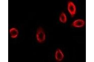 Immunofluorescent analysis of GAMT staining in U2OS cells. (GAMT antibody)