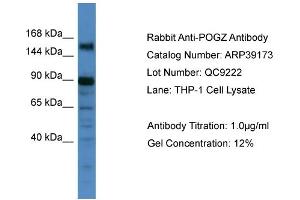 WB Suggested Anti-POGZ Antibody   Titration: 1. (POGZ antibody  (C-Term))