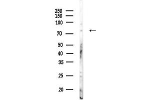 Western blot analysis of lysates from COLO205 cells, using MSP/MS Antibody at 1/1000 dilution.