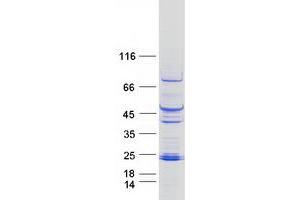 Western Blotting (WB) image for Pleckstrin Homology-Like Domain, Family A, Member 2 (PHLDA2) protein (Myc-DYKDDDDK Tag) (ABIN2728846)