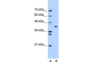 C20ORF3 antibody used at 1. (APMAP antibody  (C-Term))