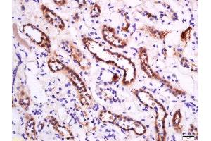 Paraformaldehyde-fixed, paraffin embedded human kidney, Antigen retrieval by boiling in sodium citrate buffer (pH6) for 15min, Block endogenous peroxidase by 3% hydrogen peroxide for 30 minutes, Blocking buffer (normal goat serum) at 37°C for 20min, Antibody incubation with Rabbit Anti-APOA1 Polyclonal Antibody, Unconjugated  at 1:200 overnight at 4°C, followed by a conjugated secondary for 90 minutes and DAB staining. (APOA1 antibody  (AA 51-150))