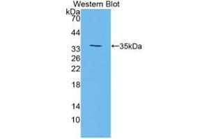 Western blot analysis of the recombinant protein. (TGM3 antibody  (AA 468-693))