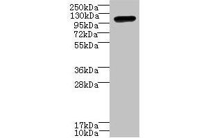 Western blot All lanes: STOX1 antibody at 8 μg/mL + HepG2 whole cell lysate Secondary Goat polyclonal to rabbit IgG at 1/10000 dilution Predicted band size: 111, 26, 20 kDa Observed band size: 111 kDa (STOX1 antibody  (AA 559-858))