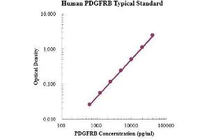 Platelet Derived Growth Factor Receptor beta (PDGFRB) ELISA Kit
