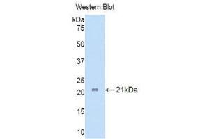 Western Blotting (WB) image for anti-Interleukin 17 Receptor A (IL17RA) (AA 377-534) antibody (ABIN3206298) (IL17RA antibody  (AA 377-534))