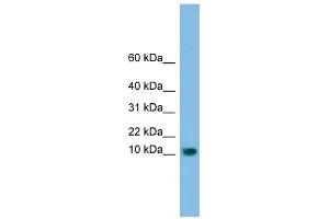 C13orf30 antibody used at 1 ug/ml to detect target protein. (C13orf30 antibody  (N-Term))