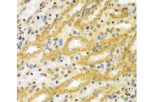 Immunohistochemistry of paraffin-embedded Mouse kidney using ADCK3 Polyclonal Antibody at dilution of 1:100 (40x lens). (COQ8A antibody)