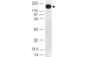 Image no. 1 for anti-DNA (Cytosine-5)-Methyltransferase 1 (DNMT1) (AA 128-429) antibody (ABIN5027162) (DNMT1 antibody  (AA 128-429))