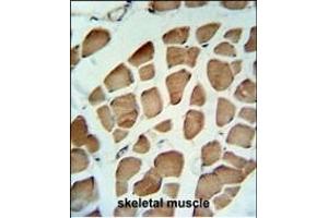 PDK2 Antibody (ABIN653784 and ABIN2843071) IHC analysis in formalin fixed and paraffin embedded skeletal muscle followed by peroxidase conjugation of the secondary antibody and DAB staining. (PDK2 antibody)