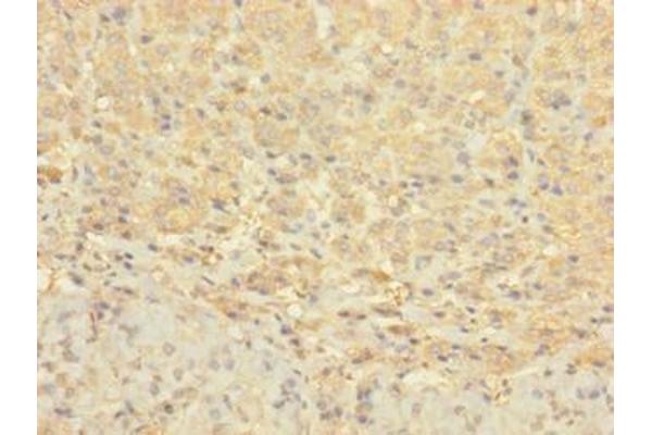 CCDC113 antibody  (AA 1-200)