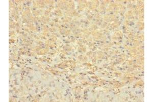 Immunohistochemistry of paraffin-embedded human adrenal gland tissue using ABIN7148072 at dilution of 1:100 (CCDC113 antibody  (AA 1-200))