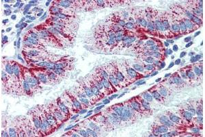 Human Uterus (formalin-fixed, paraffin-embedded) stained with HSPD1 antibody ABIN462364 followed by biotinylated anti-mouse IgG secondary antibody ABIN481714, alkaline phosphatase-streptavidin and chromogen. (HSPD1 antibody)