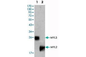 Western blot analysis using MYL3 monoclonal antibody, clone 7C1  (1) and MYL2 monoclonal antibody, clone 7C9  (2) against rat fetal heart tissue lysate.