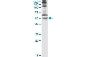 Immunoprecipitation of STK25 transfected lysate using anti-STK25 monoclonal antibody and Protein A Magnetic Bead , and immunoblotted with STK25 monoclonal antibody. (STK25 antibody  (AA 321-426))