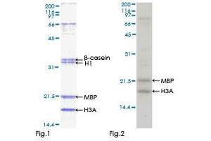 Kinase Activity Assay (KAA) image for serine/threonine Kinase 32C (STK32C) (AA 1-369) protein (GST tag) (ABIN1321692) (STK32C Protein (AA 1-369) (GST tag))