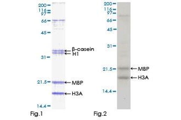 STK32C Protein (AA 1-369) (GST tag)