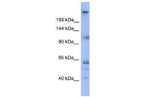 WB Suggested Anti-KNTC1  Antibody Titration: 0. (KNTC1 antibody  (N-Term))