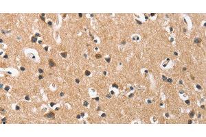 Immunohistochemistry of paraffin-embedded Human brain using DKK3 Polyclonal Antibody at dilution of 1:50 (DKK3 antibody)