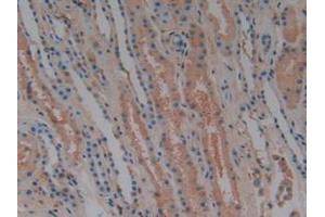 IHC-P analysis of Human Kidney Tissue, with DAB staining. (Complement Factor H antibody  (AA 860-1231))