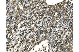 IHC analysis of CX3CR1 using anti-CX3CR1 antibody (ABIN7599293).