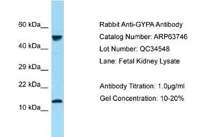Western Blotting (WB) image for anti-Glycophorin A (GYPA) (N-Term) antibody (ABIN2789608) (CD235a/GYPA antibody  (N-Term))