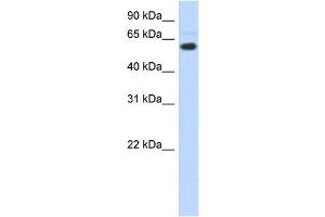 WB Suggested Anti-CDYL Antibody Titration:  0. (CDYL antibody  (N-Term))