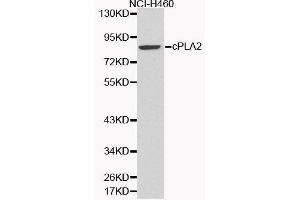 Western Blotting (WB) image for anti-Phospholipase A2, Group IVA (Cytosolic, Calcium-Dependent) (PLA2G4A) (AA 1-180) antibody (ABIN3020971) (PLA2G4A antibody  (AA 1-180))