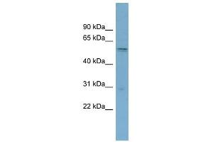 SLC7A11 antibody used at 1 ug/ml to detect target protein. (SLC7A11 antibody)