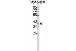 Western blot analysis of ARG1 Antibody (C-term) (ABIN652925 and ABIN2842593) in MDA-M cell line lysates (35 μg/lane). (Liver Arginase antibody  (C-Term))
