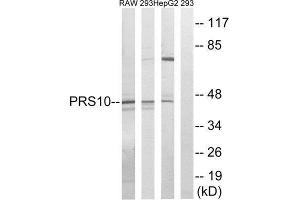 Western Blotting (WB) image for anti-Proteasome (Prosome, Macropain) 26S Subunit, ATPase, 6 (PSMC6) (Internal Region) antibody (ABIN1850520) (PSMC6 antibody  (Internal Region))