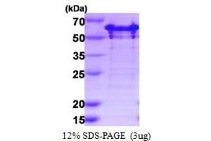 SDS-PAGE (SDS) image for GTPase Activating Protein (SH3 Domain) Binding Protein 2 (G3BP2) (AA 1-449) protein (His tag) (ABIN667638)