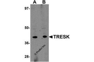 Western blot analysis of TRESK in rat brain tissue lysate with this product at (A) 1 and (B) 2 μg/ml. (KCNK18 antibody  (Center))